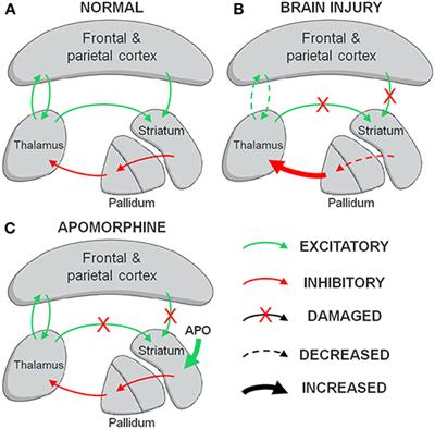 Treating Disorders of Consciousness With Apomorphine: Protocol for a Double-Blind Randomized Controlled Trial Using Multimodal Assessments